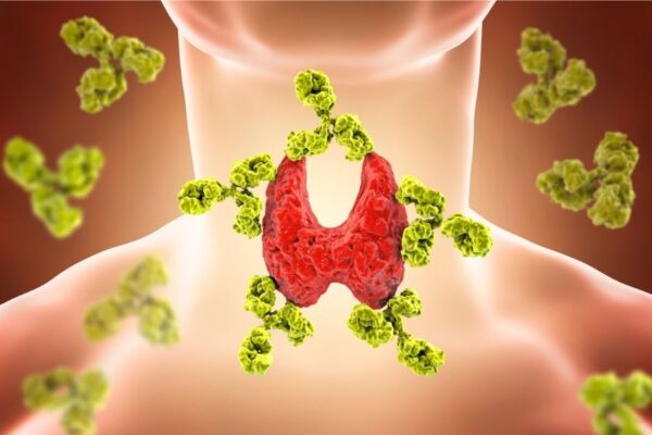 Czy dysbioza jelitowa może prowadzić do rozwoju chorób autoimmunologicznych? choroby autoimmunologiczne